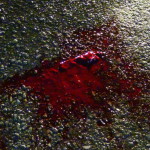 Кровь на трассе. Пешеход в тяжелом состоянии госпитализирован в горбольницу Серова.