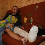 Николаю предстоит долгая реабилитация. Через 4 месяца его ждет повторная операция на левой ноге, будут удалять штырь.Фото: Мария Чекарова, “Глобус”.